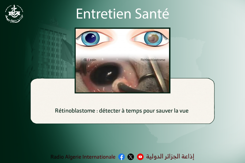 entretien santé: Rétinoblastome : détecter à temps pour sauver la vue